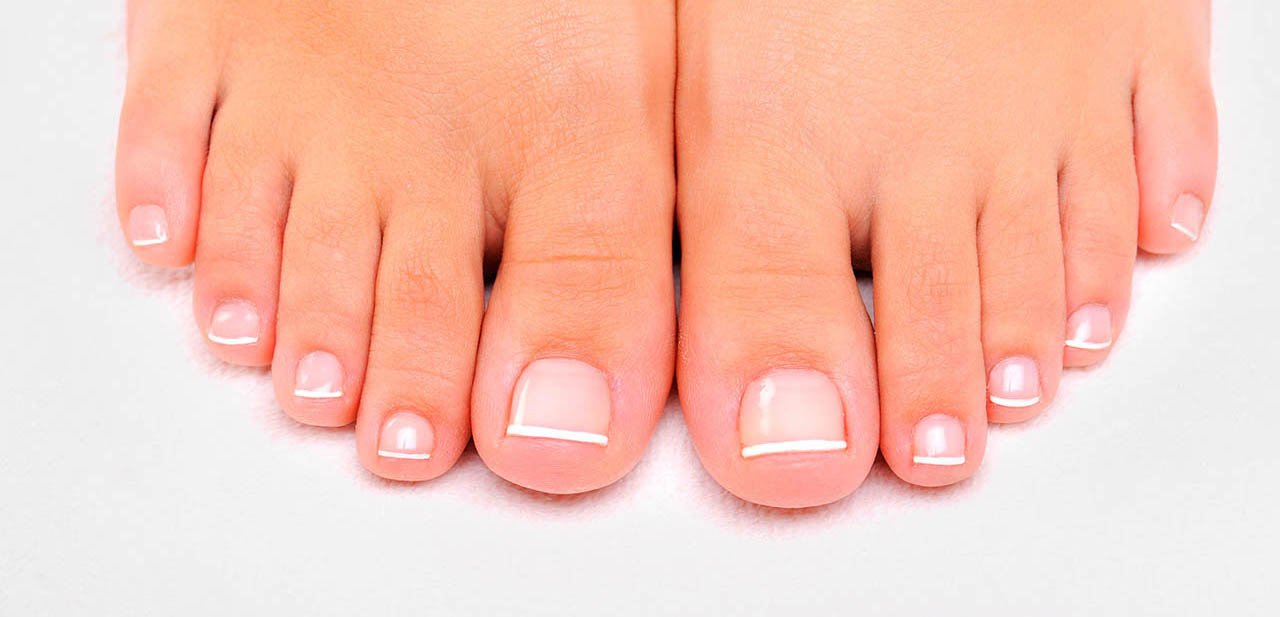 Nail Reconstruction Medipod Clinics Hinckley 01455 246100