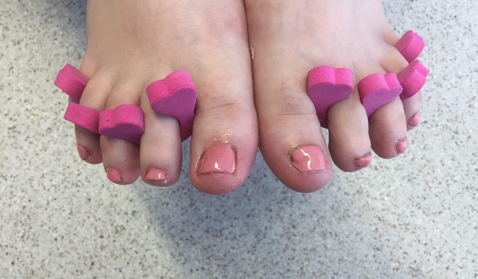 Effective Nail Reconstruction - Professional Podiatry / Chiropody 01455