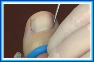 Surgical Podiatry