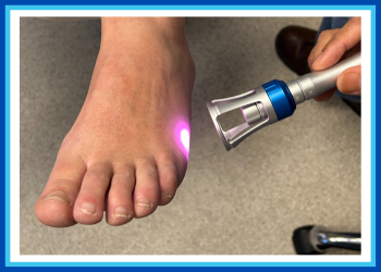 Laser Therapy – Yes there is a cure!