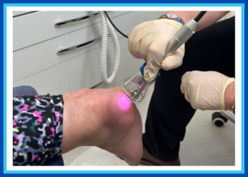 Laser Therapy – Yes there is a cure!