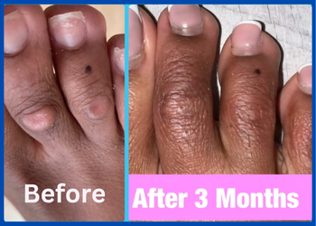 New Minor Surgery & Injection Therapy Coming