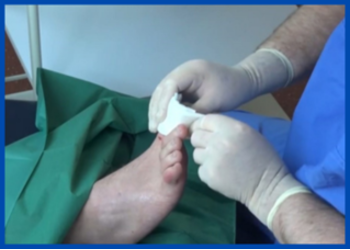 Minor Surgical Services at Medipod Clinics