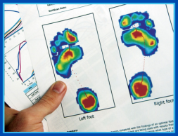 Sports Injury Management