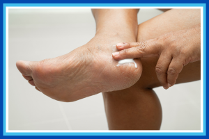 Why Heels Crack in Winter (and How to Stop It)