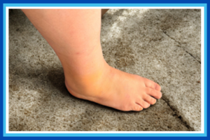 15 Years of Treating Ankles… and This Month Mine Needed the Team