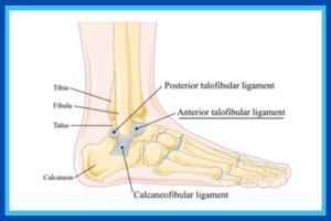 15 Years of Treating Ankles… and This Month Mine Needed the Team