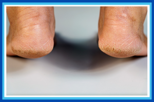 Step Into Spring: Your April Foot Health Reset Plan