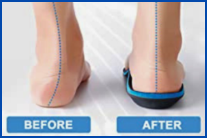 Are Your Insoles Really Helping?
